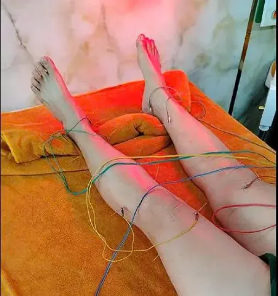 Đau Cổ Vai Gáy Khi Ngủ Dậy Là Do Đâu? 7 Nguyên Nhân Thường Gặp