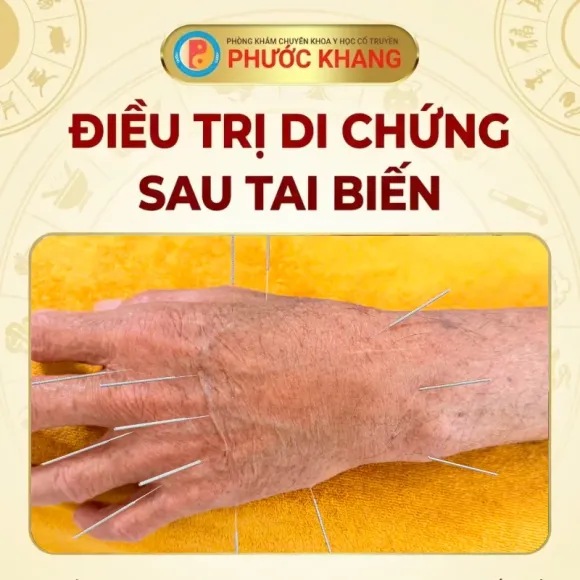 ĐIỀU TRỊ VẸO CỘT SỐNG