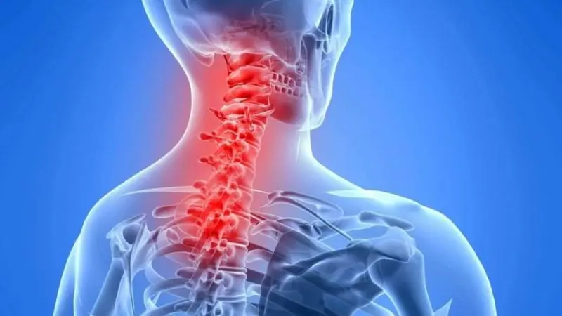 Ngồi M&aacute;y T&iacute;nh Nhiều Bị Đau Cổ Vai G&aacute;y: L&agrave;m Sao Để Giảm Kh&oacute; Chịu?