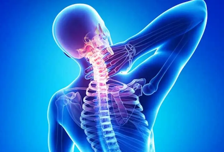 Đau Vai G&aacute;y Lan Xuống C&aacute;nh Tay C&oacute; Nguy Hiểm Kh&ocirc;ng? Khi N&agrave;o N&ecirc;n Đi Kh&aacute;m?