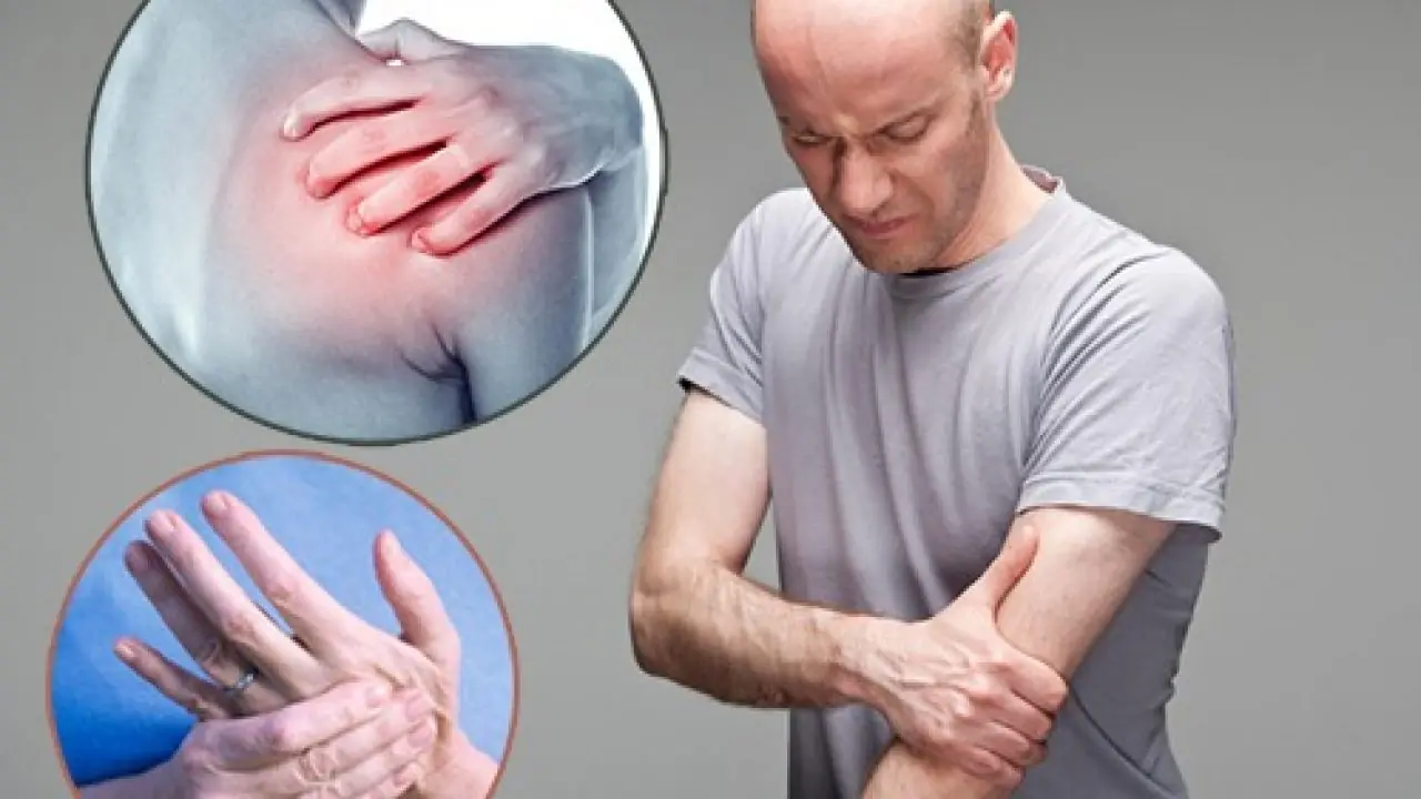 Đau Vai G&aacute;y Lan Xuống C&aacute;nh Tay C&oacute; Nguy Hiểm Kh&ocirc;ng? Khi N&agrave;o N&ecirc;n Đi Kh&aacute;m?